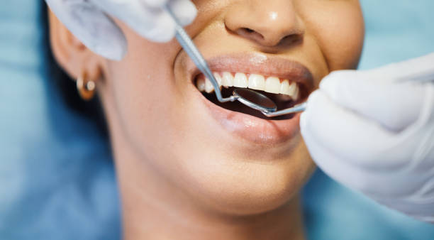 Trusted GA Emergency Dentist Experts