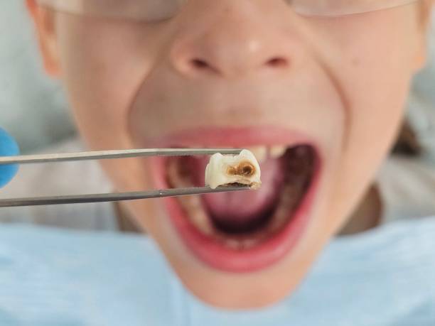 Best Weekend Emergency Dentist in Eastman, GA